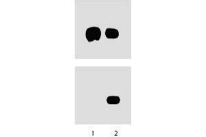 A431 cells were either left untreated (left lane) or treated (right lane) with 100 ng/ml EGF for 5 minutes at 37°C.