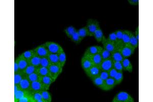 Immunofluorescence analysis of PC-12 cells using ARRB1 antibody (ABIN5996907). (beta Arrestin 1 anticorps)