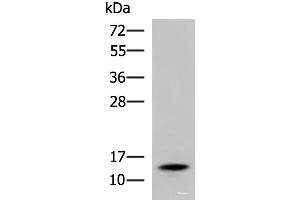 Western blot analysis of Mouse serum using TTR Polyclonal Antibody at dilution of 1:600 (TTR anticorps)