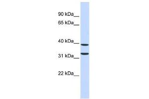 ZNF177 antibody used at 0. (ZNF177 anticorps  (Middle Region))
