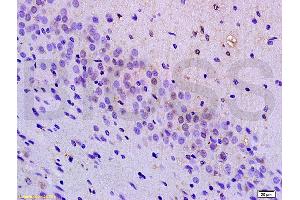 Formalin-fixed and paraffin embedded mouse brain tissue labeled with Anti-BRN3A Polyclonal Antibody, Unconjugated (ABIN702400) at 1:200 followed by conjugation to the secondary antibody, (SP-0023), and DAB staining (POU4F1 anticorps  (AA 325-419))