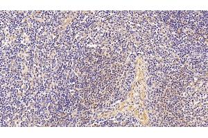 Detection of ELN in Human Lymph node Tissue using Polyclonal Antibody to Elastin (ELN)