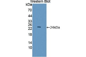 Detection of Recombinant ASCL1, Human using Polyclonal Antibody to Achaete Scute Complex Like Protein 1 (ASCL1) (Achaete Scute Complex Like Protein 1 (AA 84-236) anticorps)