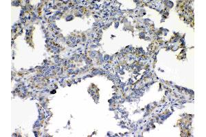 IHC analysis of TIMP4 using anti- TIMP4 antibody .
