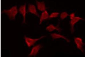 ABIN6269280 staining HepG2 by IF/ICC. (BMX anticorps  (C-Term))