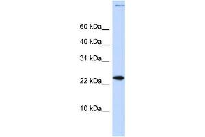 WB Suggested Anti-CHRAC1 Antibody Titration:  0. (CHRAC1 anticorps  (Middle Region))