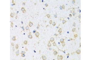 Immunohistochemistry of paraffin-embedded Mouse brain using COTL1 Polyclonal Antibody at dilution of 1:100 (40x lens). (COTL1 anticorps)