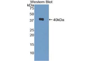 Western blot analysis of the recombinant protein. (CXCL2 anticorps  (AA 28-100))