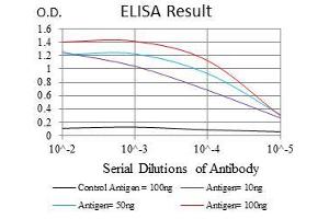 Black line: Control Antigen (100 ng), Purple line: Antigen(10 ng), Blue line: Antigen (50 ng), Red line: Antigen (100 ng), (RAF1 anticorps)