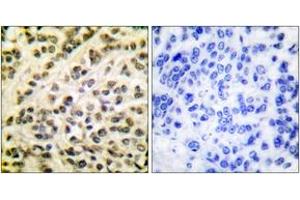 Immunohistochemistry (IHC) image for anti-Friend Leukemia Virus Integration 1 (FLI1) (AA 291-340) antibody (ABIN2889198) (FLI1 anticorps  (AA 291-340))