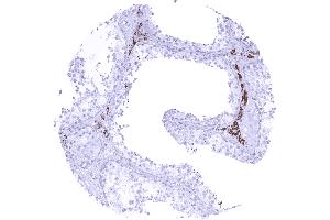 Strong cytoplasmic StAR immunostaining of Leydig cells