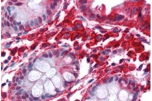 Human Colon: Formalin-Fixed, Paraffin-Embedded (FFPE)