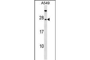 Western blot analysis in A549 cell line lysates (35ug/lane). (TBC1D28 anticorps  (AA 48-77))