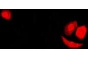 Immunofluorescent analysis of SF2 staining in U2OS cells.