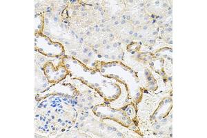 Immunohistochemistry of paraffin-embedded mouse kidney using RPS6KA3 antibody (ABIN5973157) at dilution of 1/100 (40x lens). (RPS6KA3 anticorps)