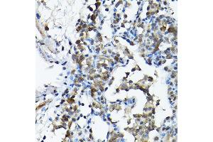 Immunohistochemistry of paraffin-embedded rat lung using PRMT5 Rabbit pAb (ABIN3022065, ABIN3022066, ABIN3022067 and ABIN6218592) at dilution of 1:200 (40x lens).
