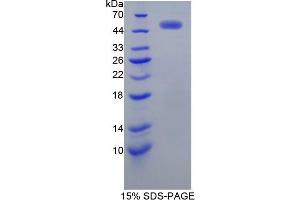 SDS-PAGE analysis of Human EGFR2 Protein. (EGFR2 Protéine)