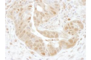 anti-Proteasome (Prosome, Macropain) 26S Subunit, Non-ATPase, 7 (PSMD7) (AA 150-200) antibody