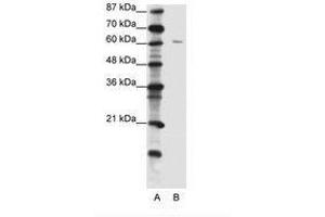Image no. 1 for anti-Zinc Finger Protein 268A (ZNF286A) (C-Term) antibody (ABIN202711) (ZNF286A anticorps  (C-Term))