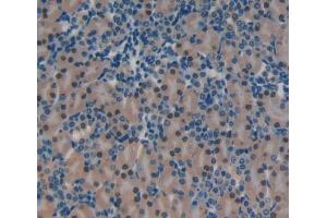 Used in DAB staining on fromalin fixed paraffin- embedded Kidney tissue (YAF2 anticorps  (AA 1-179))