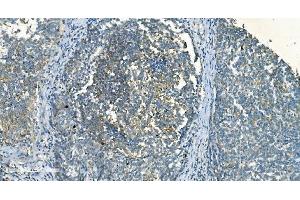 IHC analysis of IDH2 using anti-IDH2 antibody (ABIN7602786). (IDH2 anticorps  (C-Term))