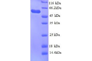 SDS-PAGE (SDS) image for Glycerol Kinase (GK) (AA 2-502) protein (His tag) (ABIN5713168)