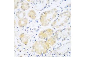 Immunohistochemistry of paraffin-embedded human stomach using C5 antibody at dilution of 1:100 (40x lens). (C5 anticorps)