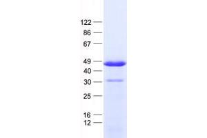 Validation with Western Blot