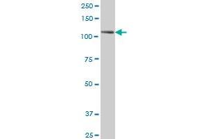 PTK7 monoclonal antibody (M02), clone 4C6 Western Blot analysis of PTK7 expression in A-431 .