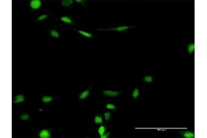 Immunofluorescence of purified MaxPab antibody to SMARCB1 on HeLa cell. (SMARCB1 anticorps  (AA 1-385))