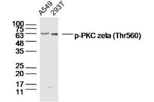 Lane 1: A549 Lane 2: 293T lysates probed with PKC zeta (Thr560) Polyclonal Antibody, Unconjugated  at 1:300 dilution and 4˚C overnight incubation. (PKC zeta anticorps  (pThr560))