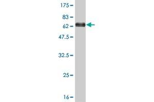 Western Blot detection against Immunogen (67. (MEIS2 anticorps  (AA 1-381))