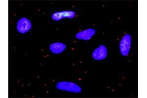 Proximity Ligation Analysis of protein-protein interactions between PDGFA and PDGFRA. (PDGFRA anticorps  (AA 25-218))