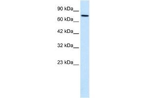 WB Suggested Anti-WHSC1 Antibody Titration:  0. (WHSC1 anticorps  (N-Term))