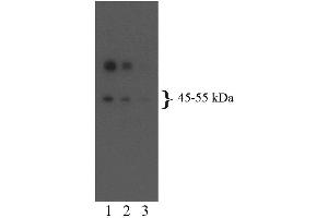 Western blot analysis for 5-HT2BR (second panel). (Serotonin Receptor 2B anticorps  (AA 1-58))