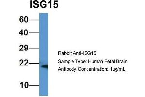 Host: Rabbit  Target Name: ISG15  Sample Tissue: Human Fetal Brain  Antibody Dilution: 1.