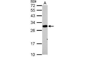 WB Image Prohibitin antibody detects PHB protein by Western blot analysis.