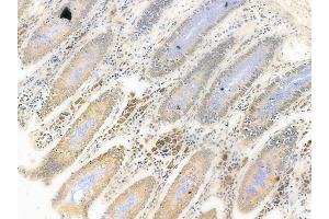 ABIN6261965 and ABIN6278698 at 1/100 staining human normal colon tissue by IHC-P. (GLI3 anticorps  (Internal Region))