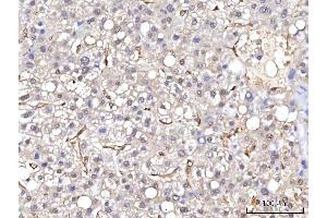 IHC analysis of RBP1 using anti-RBP1 antibody (ABIN7599586). (RBP1 anticorps  (AA 10-135))