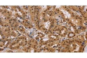anti-Cholesterol Esterase (CEL) antibody