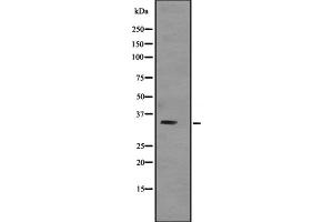 Western blot analysis of TNNT3 expression in Human skeletal muscle lysate; Mouse skeletal muscle lysate; Rat skeletal muscle lysate,The lane on the left is treated with the antigen-specific peptide. (TNNT3 anticorps  (C-Term))