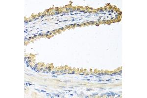 Immunohistochemistry of paraffin-embedded human prostate using COCH antibody (ABIN6132126, ABIN6138819, ABIN6138820 and ABIN6222234) at dilution of 1:100 (40x lens). (COCH anticorps  (AA 20-260))