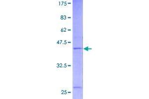 Image no. 1 for Ring Finger Protein 24 (RNF24) (AA 1-148) protein (GST tag) (ABIN1318358)