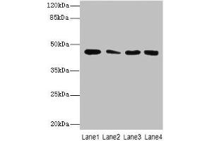 Western Blot All lanes: CBWD2 antibody at 6 μg/mL Lane 1: Mouse heart tissue Lane 2: Mouse liver tissue Lane 3: Mouse lung tissue Lane 4: Hela whole cell lysate Secondary Goat polyclonal to rabbit IgG at 1/10000 dilution Predicted band size: 45 kDa Observed band size: 45 kDa (CBWD2 anticorps  (AA 96-395))