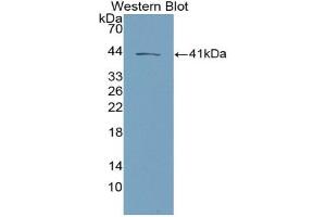 Detection of Recombinant NKB, Mouse using Polyclonal Antibody to Neurokinin B (NKB) (Tachykinin 3 anticorps  (AA 29-101))
