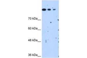 Western Blotting (WB) image for anti-SET Domain Containing 2 (SETD2) antibody (ABIN2463084) (SETD2 anticorps)