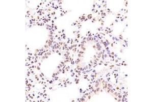 Immunohistochemistry analysis of paraffin-embedded mouse lung using,NCAPG2 (ABIN7074856) at dilution of 1: 1600 (NCAPG2 anticorps)