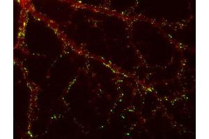 Indirect immunolabeling of PFA fixed rat hippocampus neurons with anti-SAP 102 (dilution 1 : 500; red) and mouse anti-synapsin 1 (cat. (DLG3 anticorps)