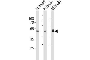 Western blot analysis of lysates from human heart, human brain, mouse brain tissue lysate (from left to right), using NDEL1 Antibody (Center) (ABIN6244172 and ABIN6577868). (NDEL1 anticorps  (AA 178-213))