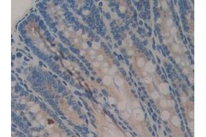 Detection of COMP in Mouse Colon Tissue using Polyclonal Antibody to Cartilage Oligomeric Matrix Protein (COMP)